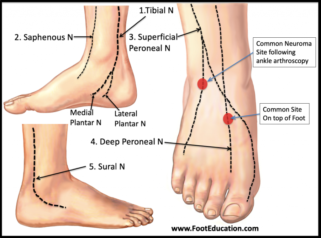 5-causes-of-numbness-in-toes-how-to-treat-numbness-in-toes