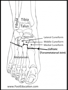 Lisfranc Injury - FootEducation