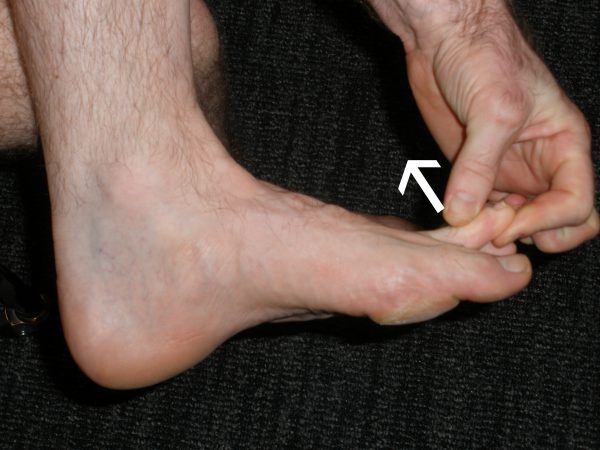 Toe Flexibility Exercises Footeducation