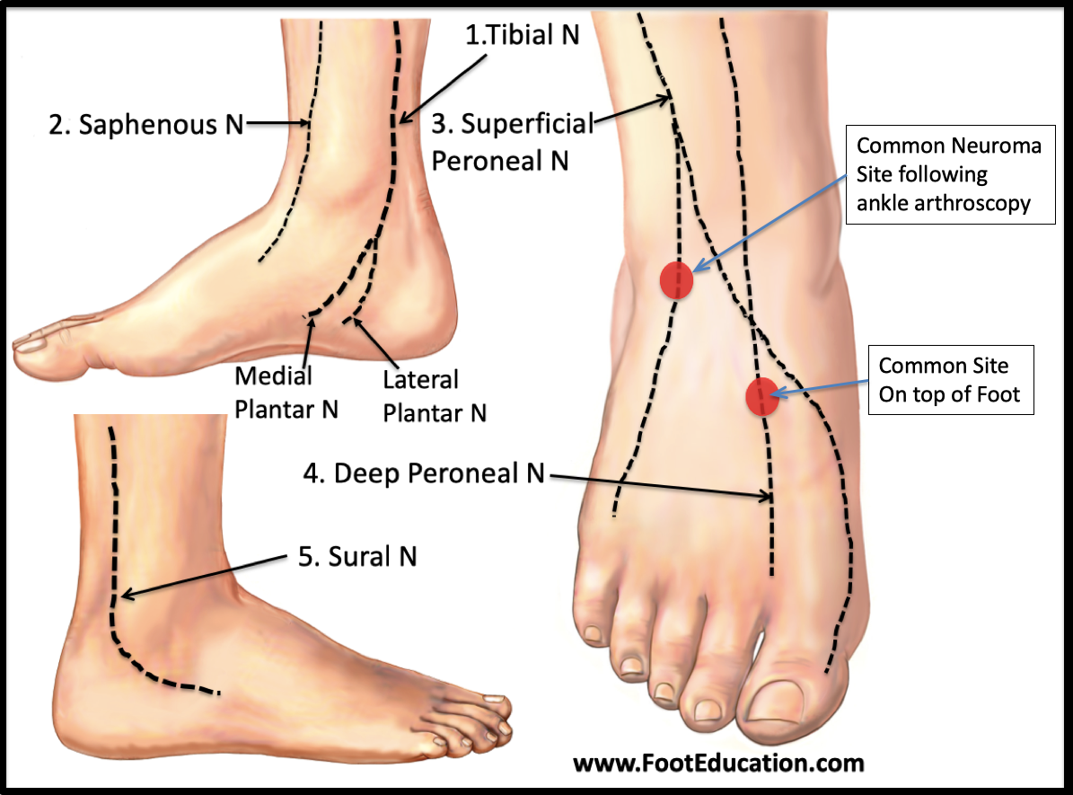 Nerve Pain In Foot: Causes, Symptoms Nerve pain in the foot