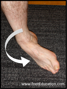 Ankle Inversion, the typical mechanism of injury of an ankle sprain.