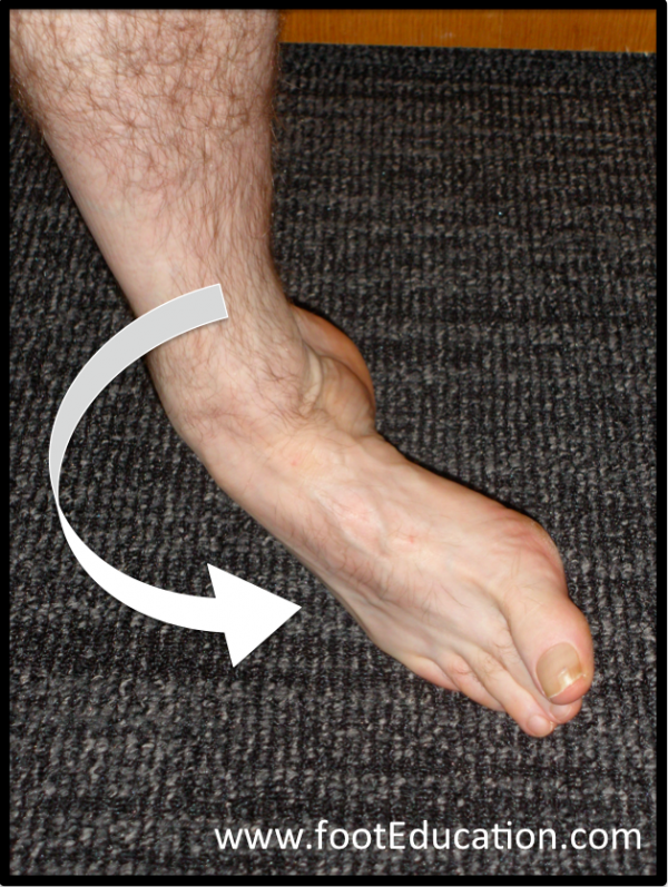sprained-ankle-footeducation