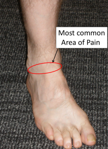 pain in front of heel