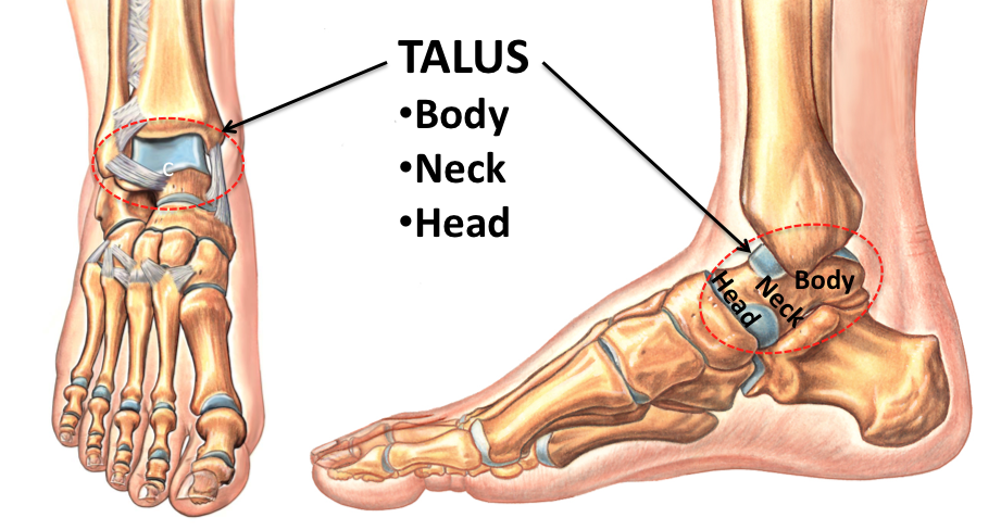 Talar Body Fracture - FootEducation