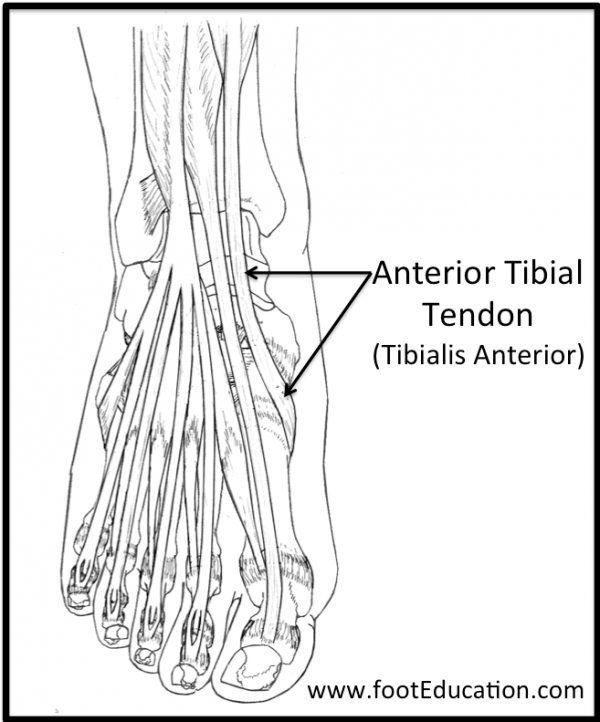 Tendinitis Del Tibial Anterior Isnca 4514