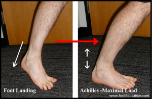 Achilles Tendon Ruptures Mechanism of Injury - Sudden Change of Direction to Maximal Achilles Load