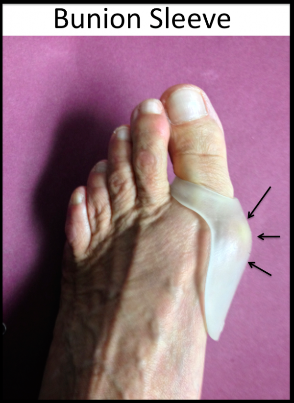 Bunions - FootEducation