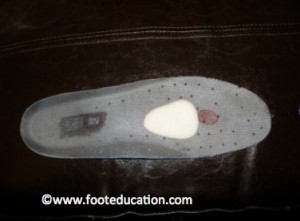 Metatarsal Pad