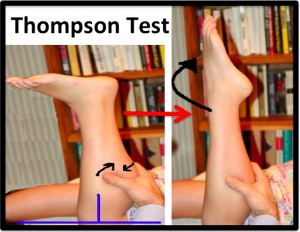 The Thompson Test