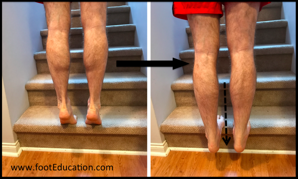 La Tendinite Du Tendon Dachille Footeducation