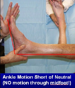 Limited motion through the ankle joint 