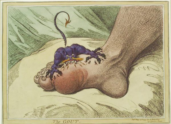 The Gout" by James Gilray 1799