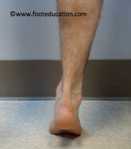Ability to do a single leg heel rise