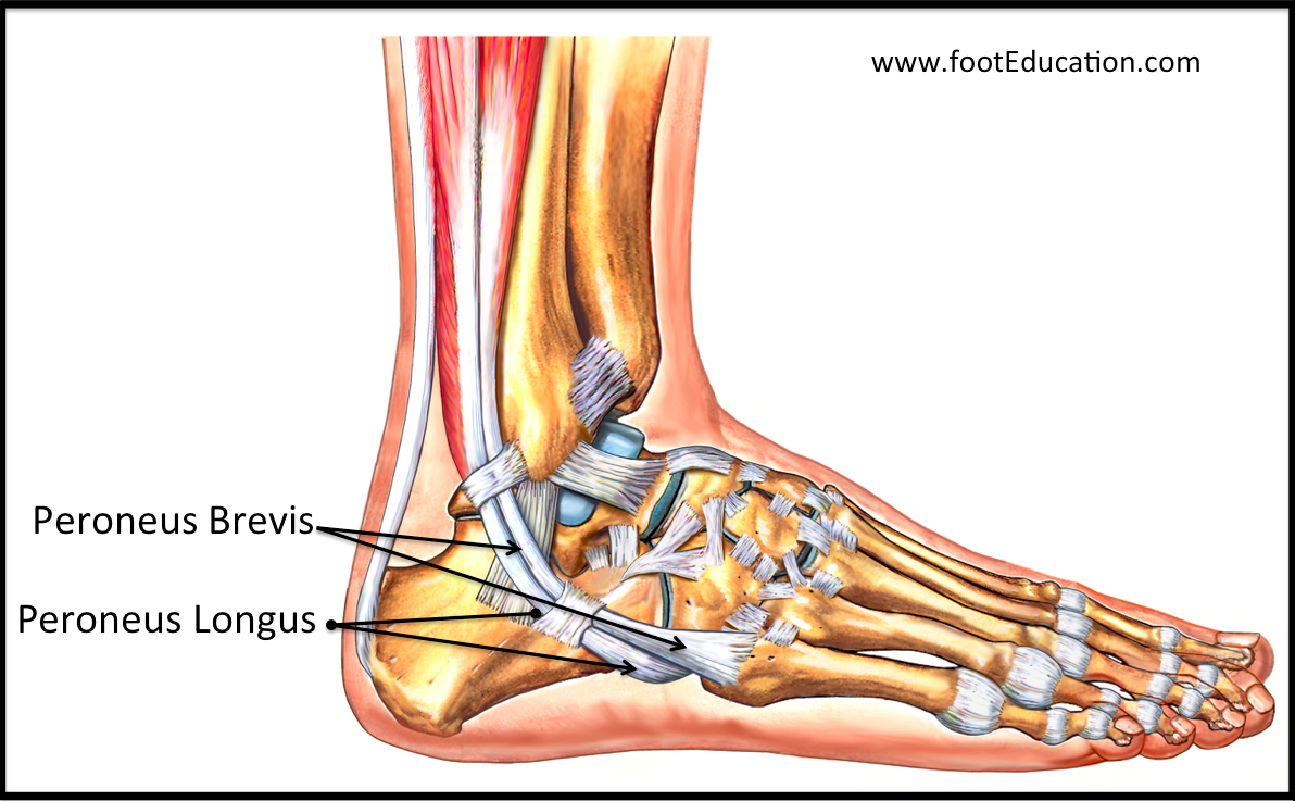 peroneal-tendonitis-footeducation