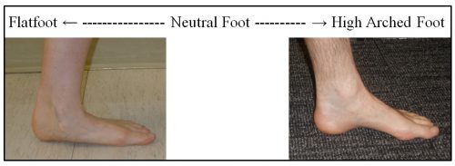 Foot Type Spectrum