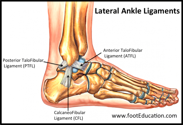 Bring Peace and Love to Your Ankle Sprain Recovery - Rehabilitation Advice