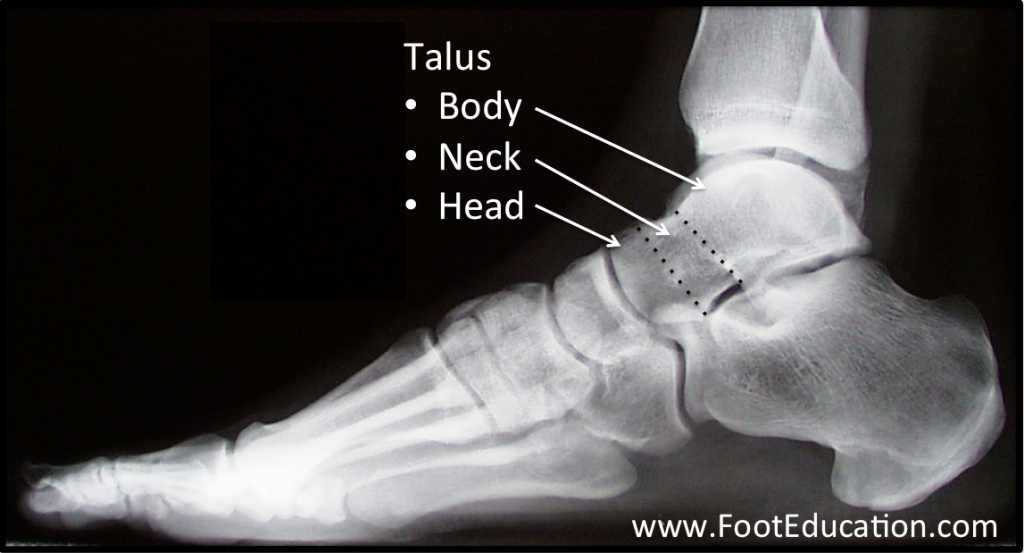 Bones And Joints Of The Foot And Ankle Overview Footeducation