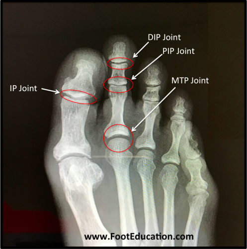 Oversigt Over Knogler Og Led I Fod Og Ankel RegTech   Figure 8 Joints Of The Toes 497x500 