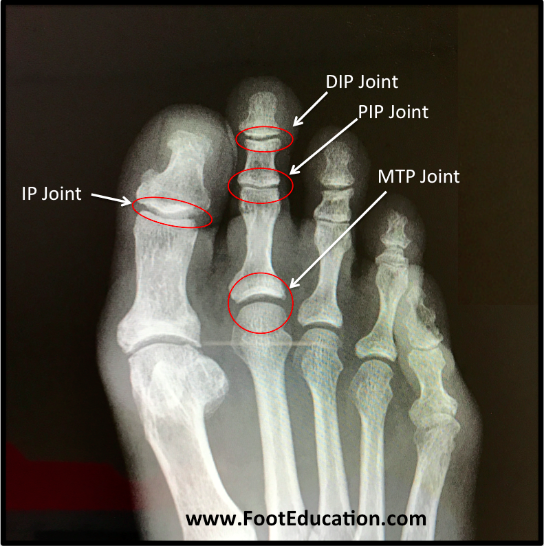 Joints Of The Foot Diagram