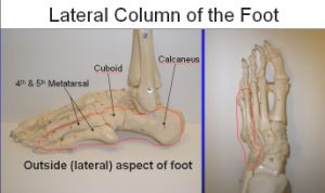 lateral lengthening footeducation