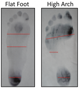 empreintes d'un pied plat et d'un pied à forte arche sur tapis de Harris