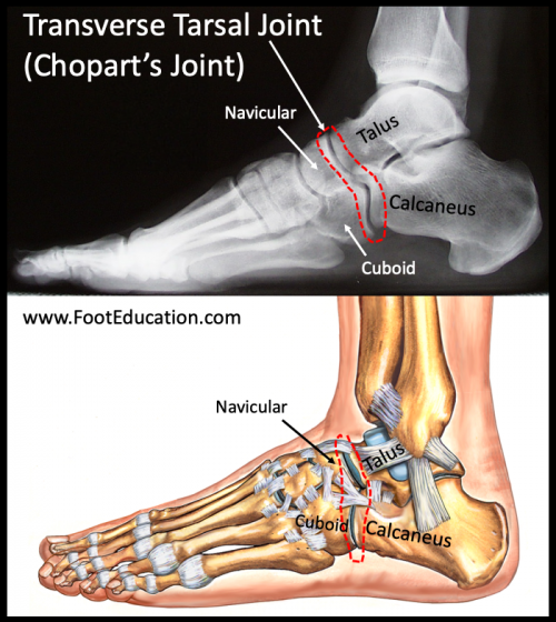 Transverse Tarsal Joint Injury-Sprain - FootEducation