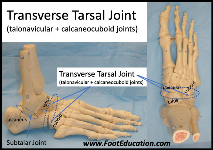 Transverse tarsal joint
