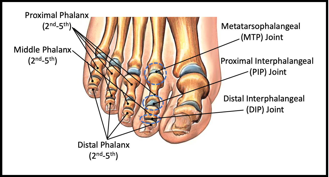 Stubbing Your Toe: The Manageable, the Bad, and the Ugly! - FootEducation