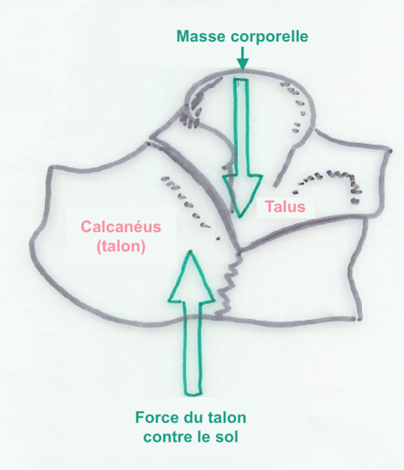 Mécanisme typique d’une fracture du calcanéus – Vue latérale