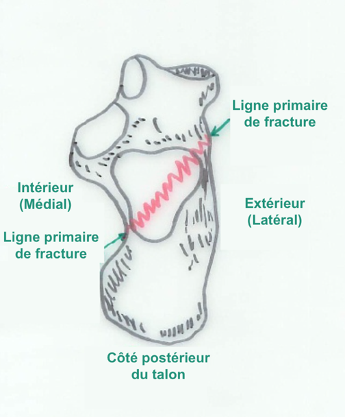 Ligne de fracture primaire vue de haut (montrant aussi des lignes de fracture secondaires)