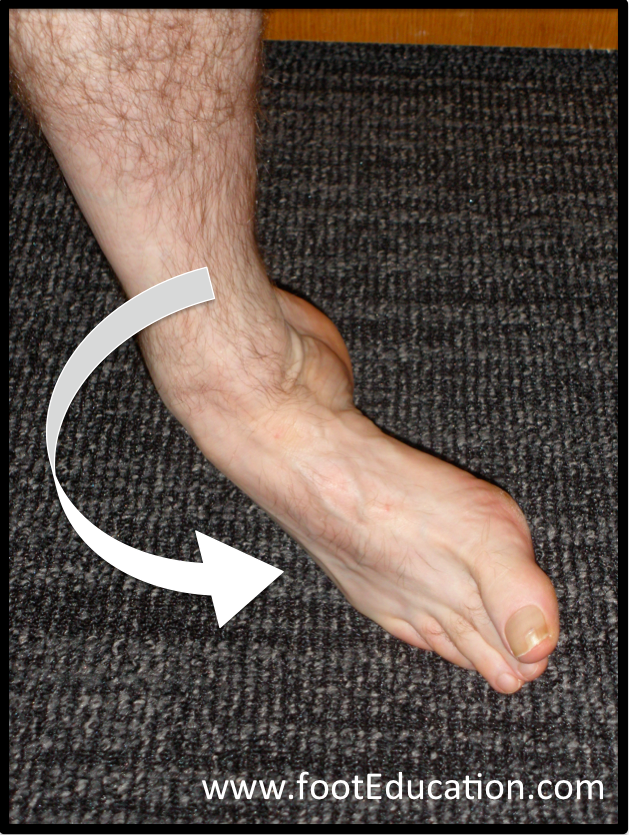 5th metatarsal avulsion fracture mechanism of injury