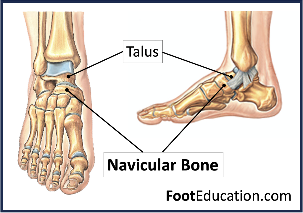 Diagram illustrating the location of navicular bone